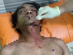 Rewel Dan Ditukar…!!! Dar Der Dor….Warga Pecalukan Jadi Korban Penembakan