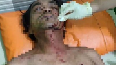 Rewel Dan Ditukar…!!! Dar Der Dor….Warga Pecalukan Jadi Korban Penembakan