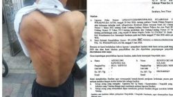 Tiga Anak di Bawah Umur Diduga Dianiaya di Lingkungan Majelis Zikir Bulak Rukem Surabaya, Polisi Terima Laporan