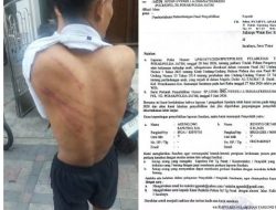 Tiga Anak di Bawah Umur Diduga Dianiaya di Lingkungan Majelis Zikir Bulak Rukem Surabaya, Polisi Terima Laporan